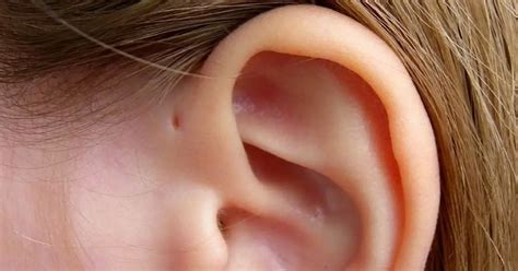 if you have a tiny hole above your ear here s what it means