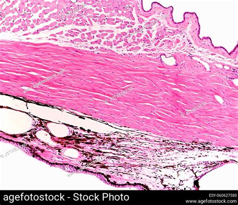 Non Keratinized Stratified Squamous Epithelium Stock Photos And Images