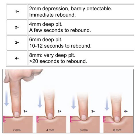 Pitting Edema Scale ⭐️ Nursing School Notes Nursing School Tips