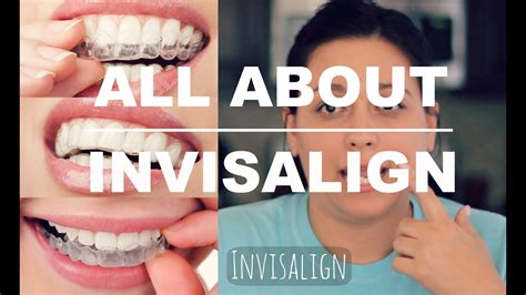 Invisalign Review How It Works And What To Expect Youtube