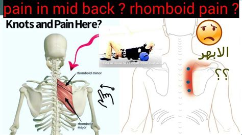 تمارين اعلى الظهر الابهر Mid Back Pain Rhomboids Pain Exercises Part 1