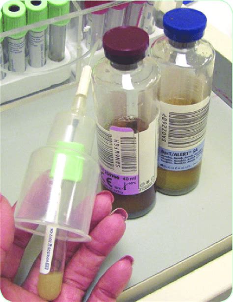 Blood Culture Bottles Which First Best Pictures And Decription