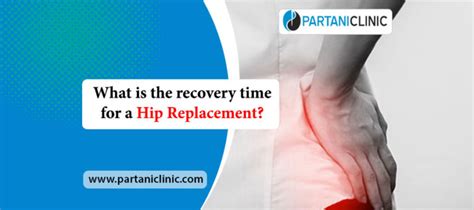 What Is The Recovery Time For Hip Replacement Surgery