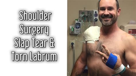 Shoulder Surgery Is Done Slap Tear Torn Labrum Fraying Tendons Torn