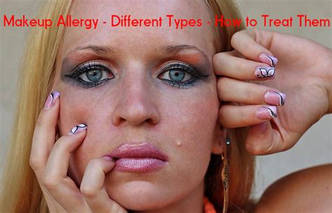 Makeup Allergy Reactions Types How To Treat Them Stylish Walks