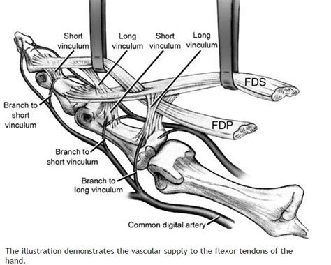 Identify the muscles fpl, fcu, fcr, fds and fdp by either following their tendon from their insertion or by their anatomical relation to each other. Ortho Blog - CMC COMPENDIUM