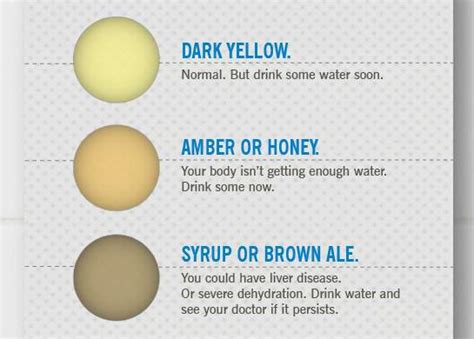 Is Your Pee The Right Color Infographic