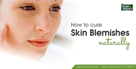 How To Cure Skin Blemishes Naturally Roop Mantra Blog Skin Care