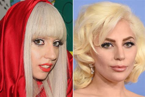 Lady Gaga Plastic Surgery Facts Rumors And Expert Opinions