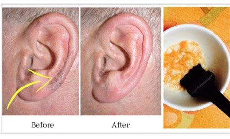 3 Easy Remedies To Get Rid Of Ear Hair Today Ehealthyfood Ear Hair