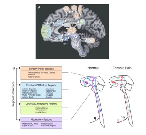 A Overview Of Pain Pathways And Altered Neural Systems In Chronic