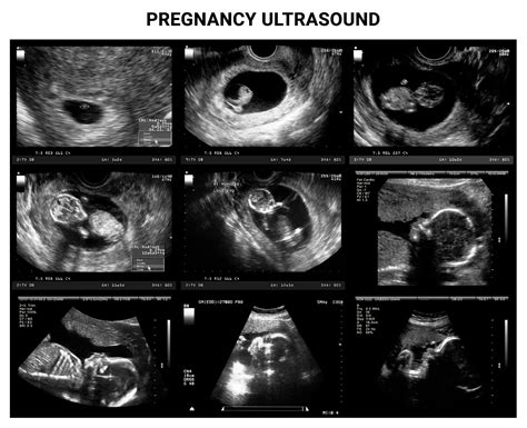 Ultrasounds During Pregnancy What You Need To Know Century Medical And Dental Center