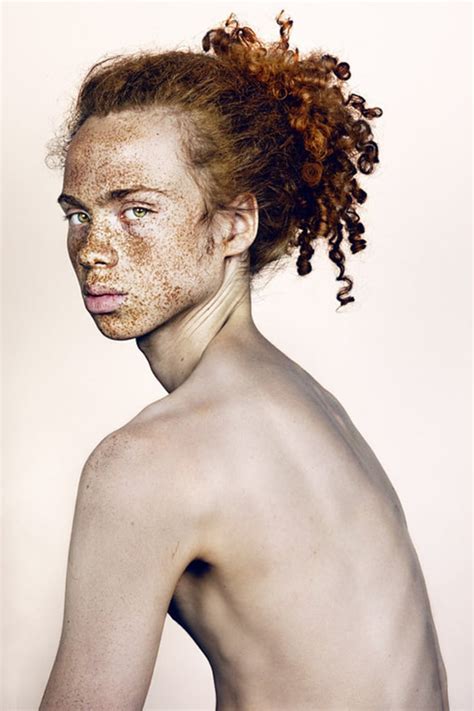 Freckles Photographer Shines Spotlight On The Beauty Of Spots