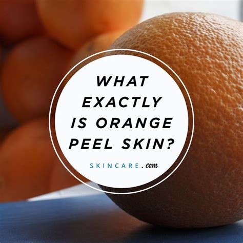 Orange Peel Texture Skin How To Improve The Appearance Of Your Skin