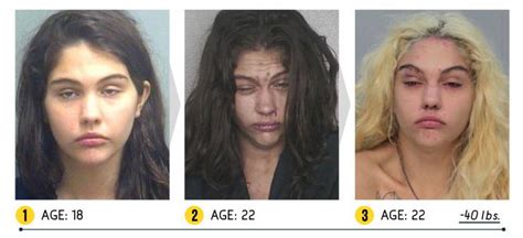 Before And After Meth Addict Pictures Mugshots Reveal Shocking Toll Of