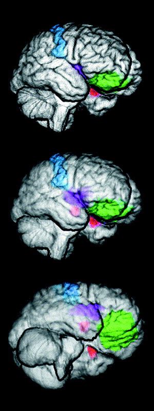 Social Cognition And The Human Brain Trends In Cognitive Sciences