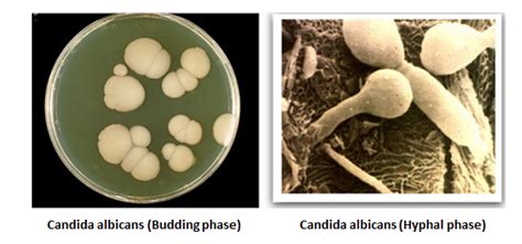 Candida Albicans Morphology On Curezone Image Gallery