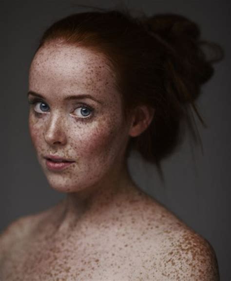 Gorgeous I Love Freckles Beautiful Freckles Freckles Girl Redheads Freckles
