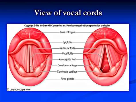 Vocal Cord Dysfunction Powerpoint Presentation Vocal Cord Dysfunction Vocal Warmups Singing