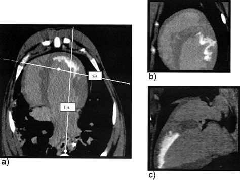Contrast Enhanced Multidetector Computed Tomography Viability Imaging