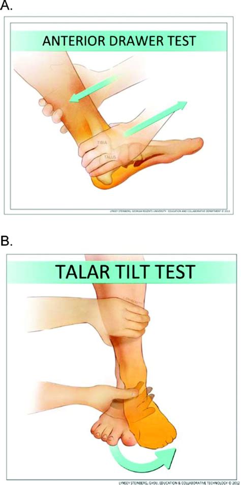 Learn about the causes of peroneus brevis pain or strain, its signs, symptoms, treatment and recovery period. Split Peroneus Brevis Tendon: An Unusual Cause of Ankle ...