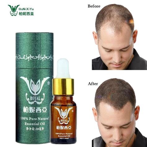 Heat protection spray comes between your hair and the heat source, preventing any singeing that could occur with direct contact. Hair Growth Products Natural With No Side Effects Faster ...