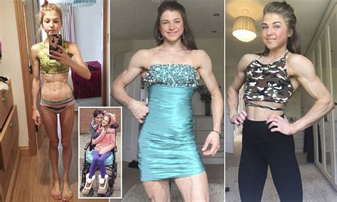 Anorexic Whose Weight Plummeted To Five Stone Turned Life Around To
