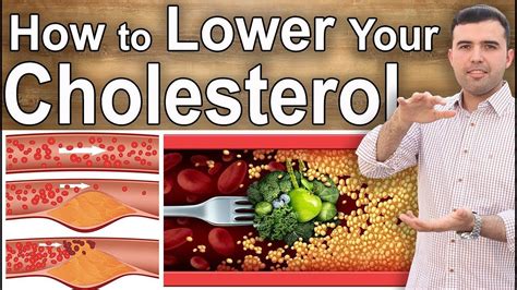 If your gp has advised you to change your diet to reduce your blood cholesterol, the most important thing to do is to cut down on saturated fat. How to Lower High Cholesterol Naturally - Diet and ...