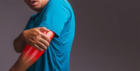 Luxação não é contusão: entenda as características desse tipo de lesão