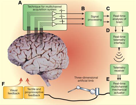 Brain Machine Interfaces From Basic Science To Neuroprostheses And