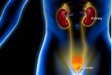 How Do Doctors Test For Kidney Infection