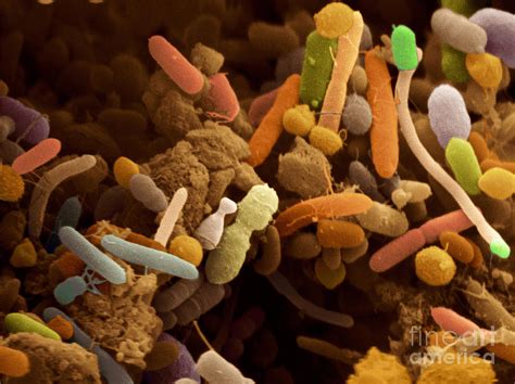 Bacteria In Human Feces Sem Photograph By Scimat Fine Art America
