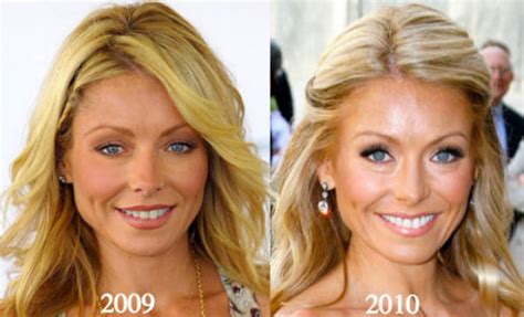Kelly Ripa Plastic Surgery Before And After Photos Latest Plastic