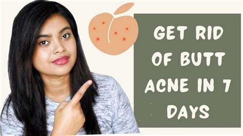 How To Get Rid Of Butt Acne In Days Butt Acne Treatment Natural