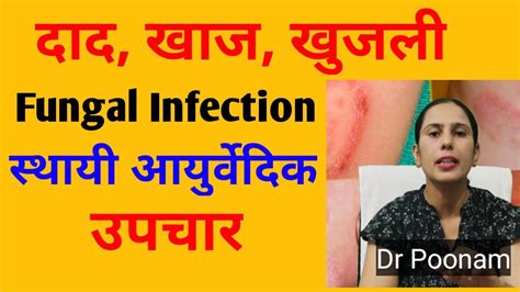 Fungal Infection On Skin Fungal Infection Treatment Fungal