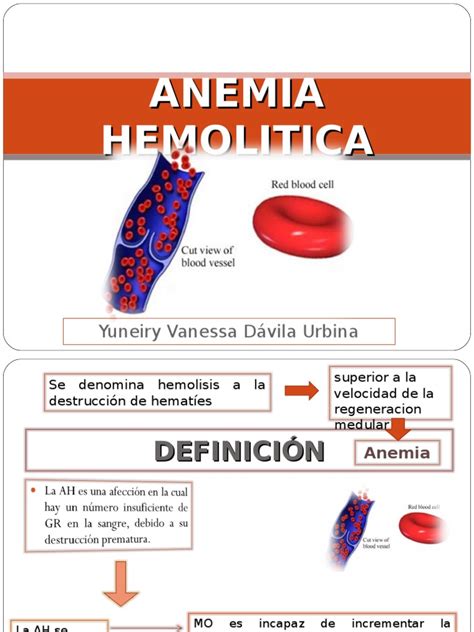 Anemia Hemolitica Final Pdf Glóbulo Rojo Especialidades Medicas