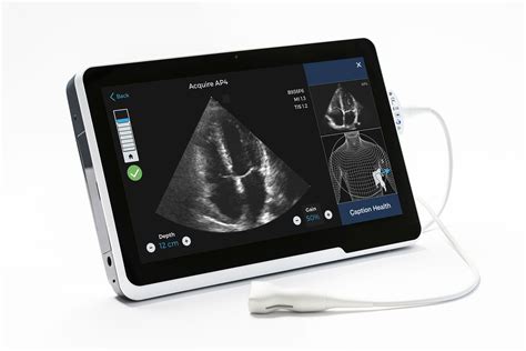 Fda Approves Caption Healths Ai Powered Cardiac Ultrasound Software