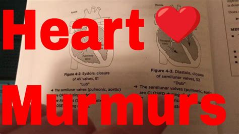 We did not find results for: Heart Murmurs - YouTube