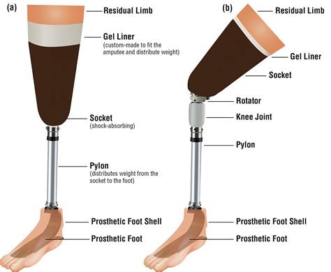 Photo Gallery And Diagrams Caf Prosthetic Socket