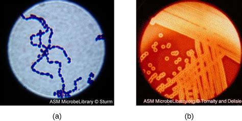 Gram Positive Bacteria Microbiology