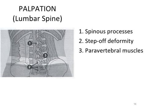 Kin191 Ach10 Lumbar Thoracic Evaluation