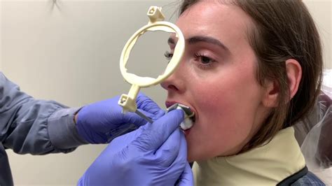 How To Take Maxillary Anterior Periapical Radiograph Using Sensor Youtube
