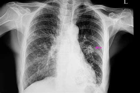Pneumonia Detection Using Chest X Ray Images Models Profile