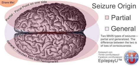 These seizures involve a change or loss of consciousness or atonic seizures, also known as drop seizures, cause a loss of muscle control. There are two types of seizures - partial and generalized ...