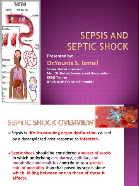 Septic Shock Pdf Sepsis Shock Circulatory