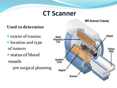 Distinguish Between Ct Versus Cta Exam In Radiology Medical Coding Guide