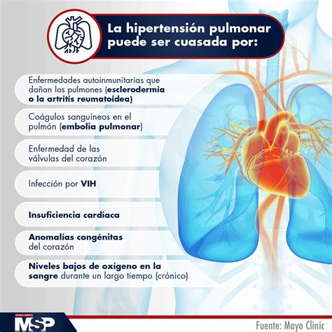 Día Internacional De La Hipertensión Pulmonar