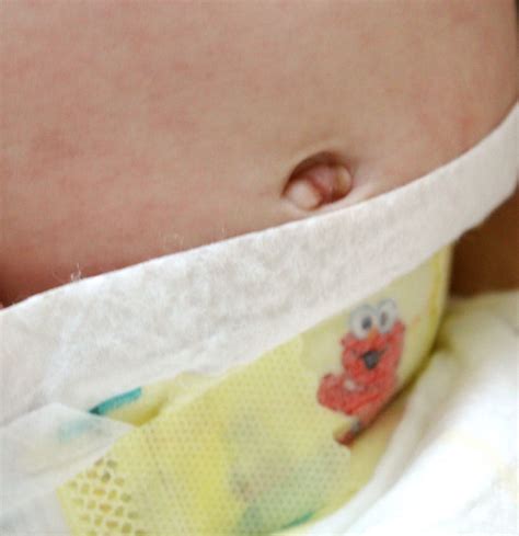 Some pediatric providers recommend only sponge baths until the cord falls off. What Happens After The Umbilical Cord Falls Off | Baby ...