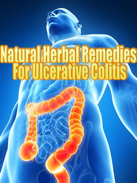Natural Herbal Remedies For Ulcerative Colitis Great Med Work
