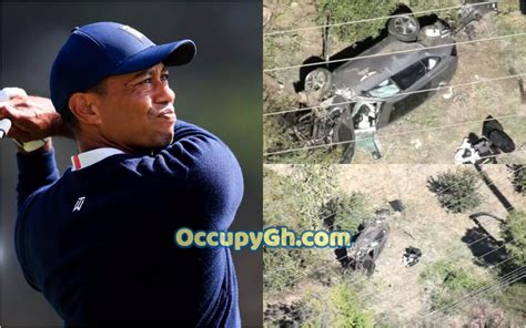 Tiger Woods Hospitalized With Multiple Leg Injuries After Involving In